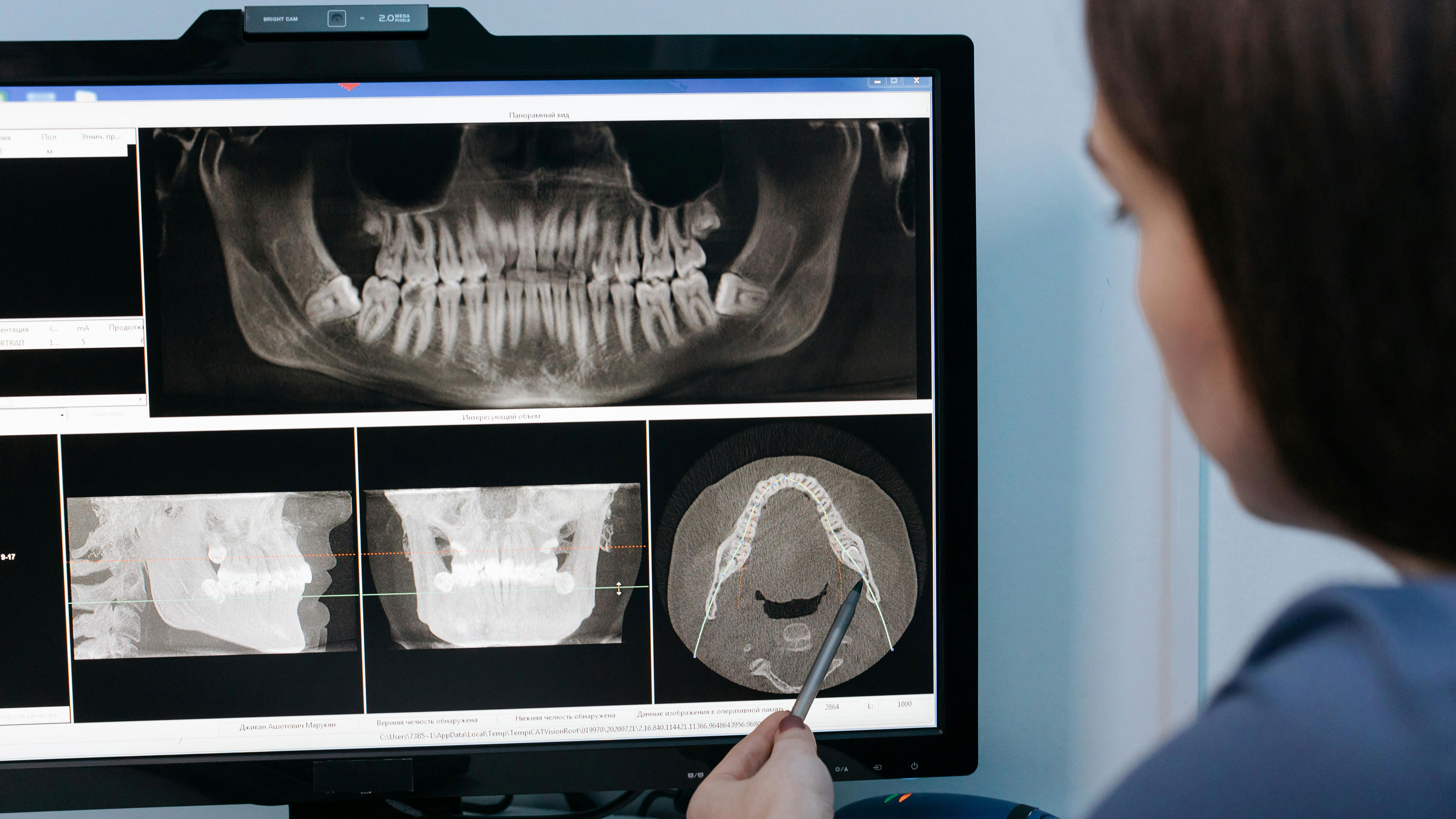 Flexslider 01 | Smile Doctors Dental Center