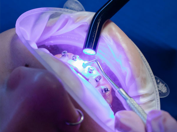 Orthodontics | Smile Doctors Dental Center